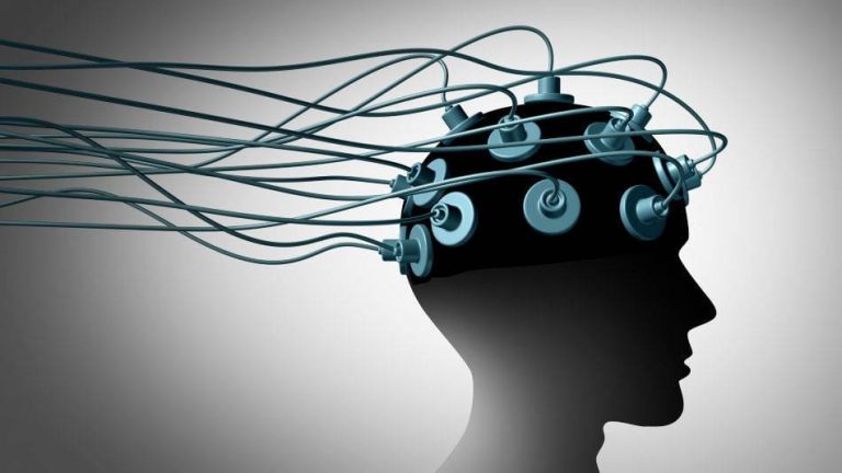 Representacion-de-electrodos-para-realizar-neuroterapia